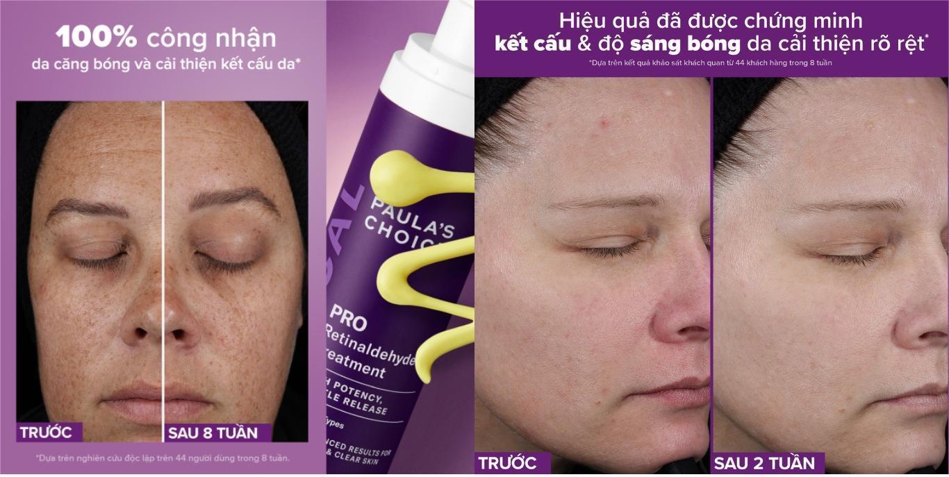 chăm sóc da - hiệu quả cải thiện nếp nhăn và kết cấu da của Paula's Choice Pro Retinaldehyde Treatment