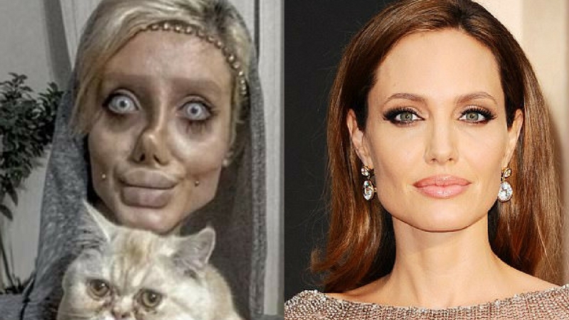 Nổi tiếng sau 50 lần phẫu thuật thẩm mỹ để trở thành Angelina Jolie