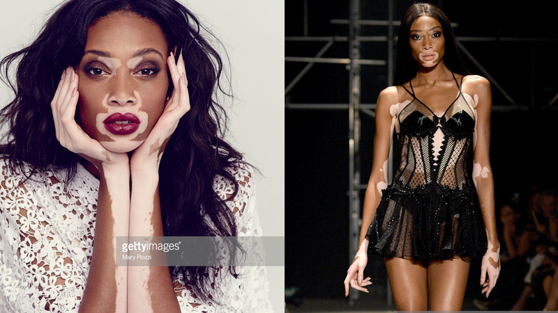 [Điểm tin thời trang] Người mẫu Winnie Harlow sẽ diễn trong Victoria's Secret show, Burberry ngưng sử dụng da thật