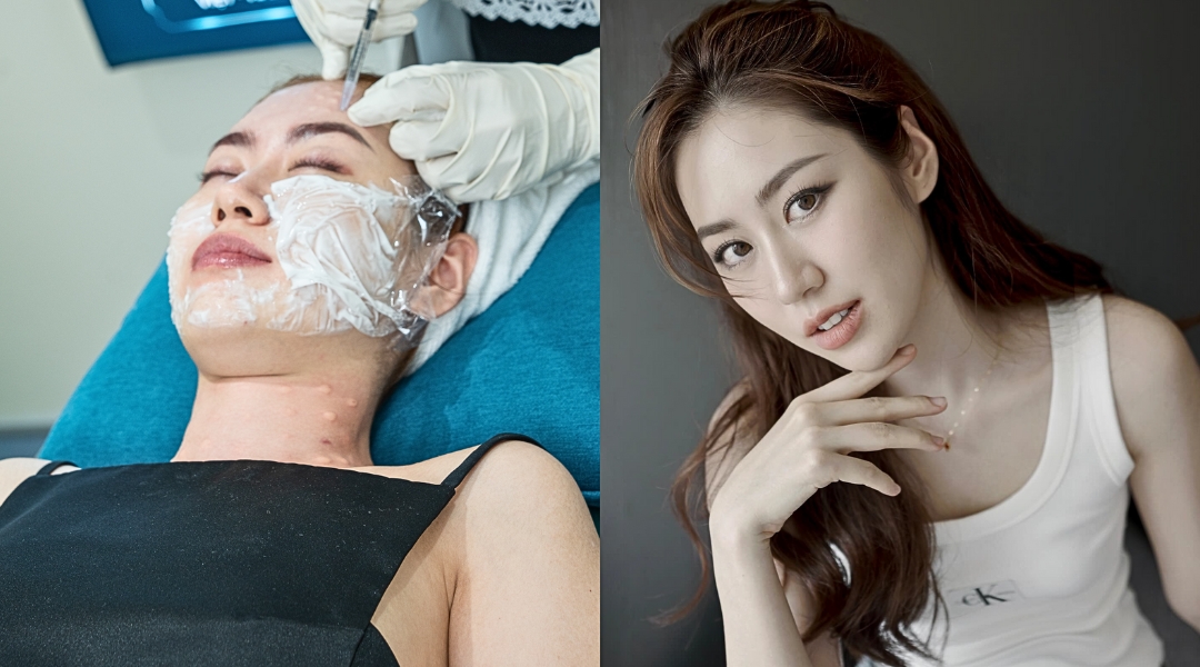 Mai Vân Trang sử dụng liệu pháp trẻ hóa da Meratox Therapy